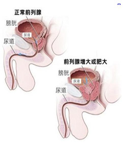 富锦北大泌尿医院